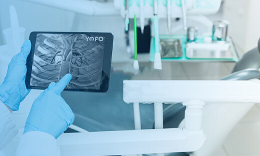 CT影像技術設備制造商“有方醫療”完成5000萬元Pre-A輪融資，華穎投資領投