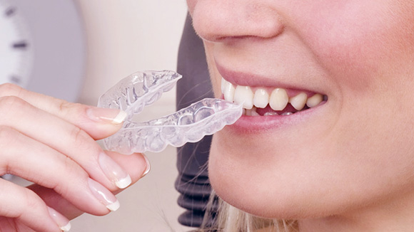 市值超700億港元，從IPO火爆看“時代天使”的隱形牙套生意經(jīng)