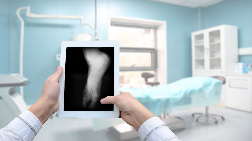 ”威高骨科“IPO：216项专利，18亿营收，稳坐国内骨科龙头