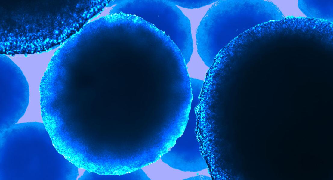 神经干细胞技术及药物研发商霍德生物完成数亿元B轮融资，高瓴创投领投