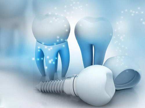 種牙自由還有多遠？種牙醞釀納入醫保，“種牙險”多已停售