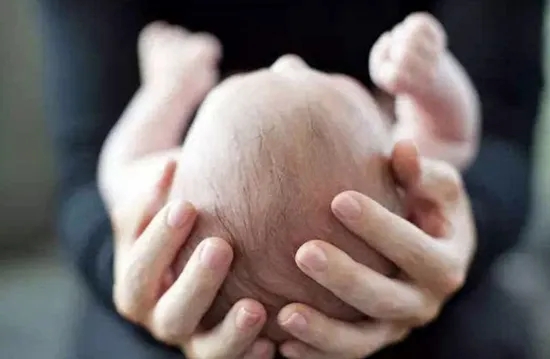 专注婴儿头型矫正，云量几何获奇绩创坛、壹叁资本等数千万元投资