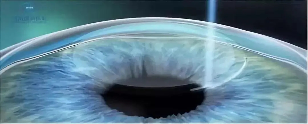 聚焦飞秒激光器设备研发，卓镱辉完成数千万元A+轮融资