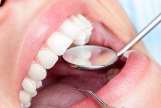 启明创投独家投资，口腔隐形正畸品牌可丽尔博士完成亿元级A轮融资