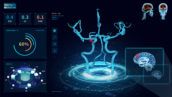 强联智创?完成亿元D+轮融资，专注脑血管病智能诊疗